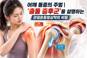 어깨 통증의 주범 | ‘충돌 증후군’을 설명하는 관절운동형상학의 비밀
